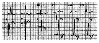 2016年安徽成人高考专升本《医学综合》考试真题1
