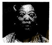 2017年安徽成人高考专升本《医学综合》考试真题2