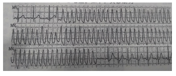 2017年安徽成人高考专升本《医学综合》考试真题3