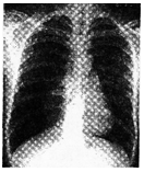 2017年安徽成人高考专升本《医学综合》考试真题1